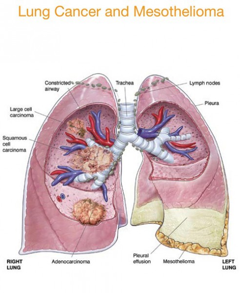 lung diagram worksheet
