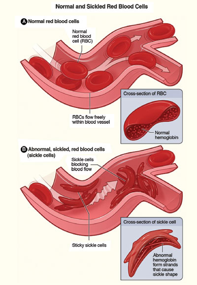 red blood cell diagram